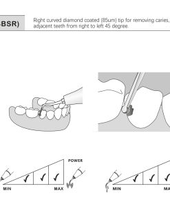 cavity preparation tip sbr